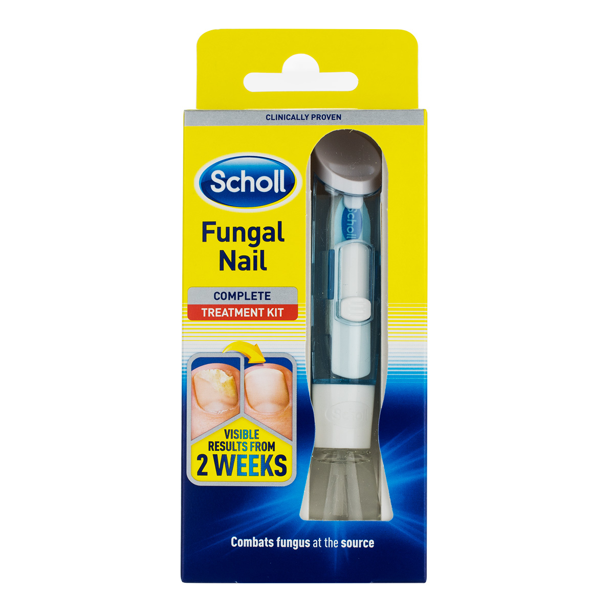 Scholl Fungal Nail Treatment Kit BeautyBuys Ireland